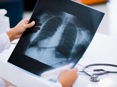 Radiografie e raggi X
